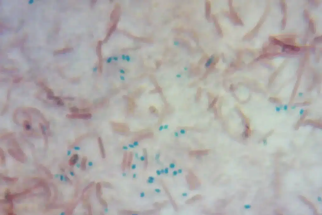 Почему опасно подогревать рис: там могут образоваться бактерии типа Bacillus cereus.