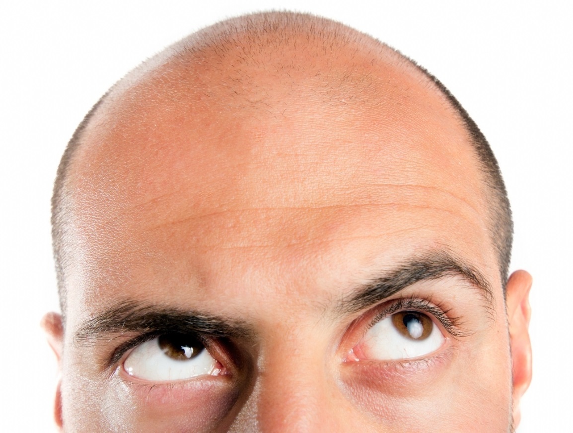 Ученые нашли неожиданное средство от облысения