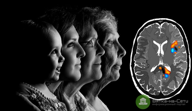 Старение мозга мужчин и женщин: ученые сделали открытие