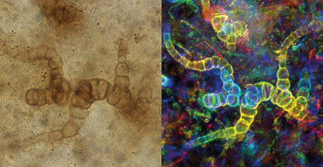 Бактерии возрастом 5000 лет могут изменить борьбу с супербактериями