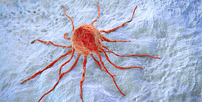 Почти каждый третий рак можно предотвратить